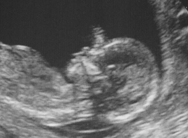 FR 15 Week Scan2